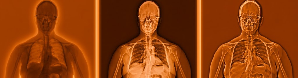 Real-World Screening Data